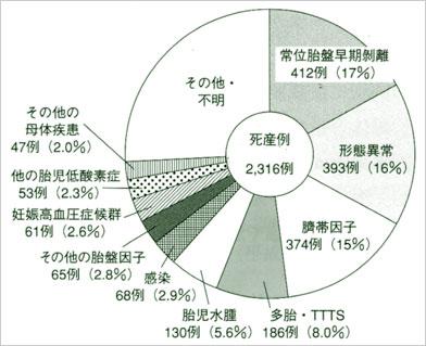 図1　死産の原因および背景因